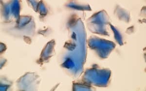 Polarized light microscopy 